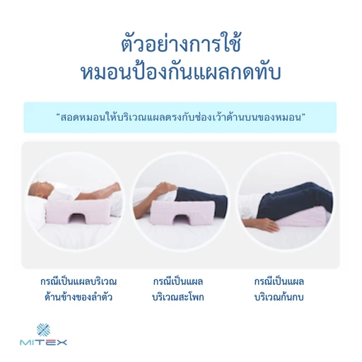 วิธีใช้หมอนป้องกันแผล⁠กด⁠ทับไม⁠เท็กซ์